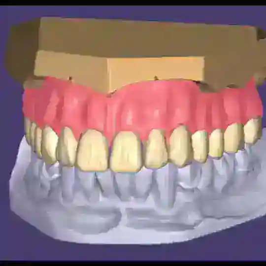 exocad-3shape-cerec expert Profile