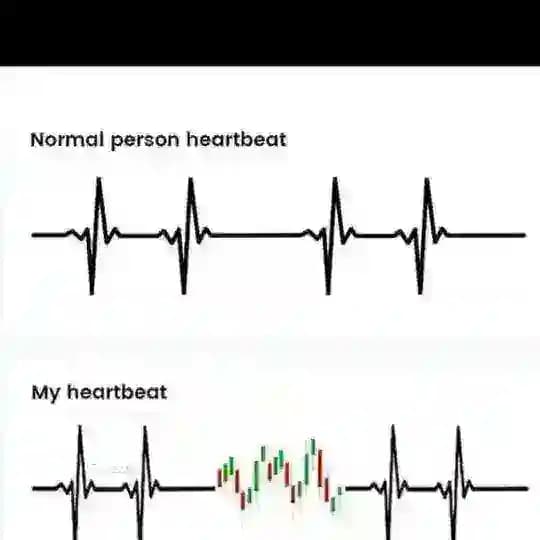 STOCK OPTION EARNING Profile