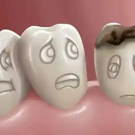 Periodont and periodontitis Profile